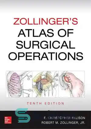 دانلود کتاب Zollinger’s atlas of surgical operations – اطلس عمل های جراحی زولینگر